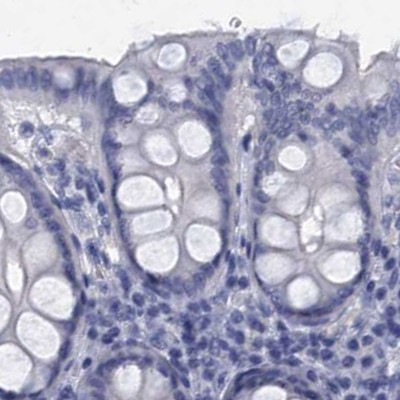 CYP51A1 Antibody in Immunohistochemistry (IHC)