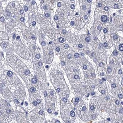 CYP51A1 Antibody in Immunohistochemistry (IHC)