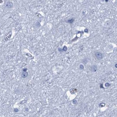 CYP51A1 Antibody in Immunohistochemistry (IHC)