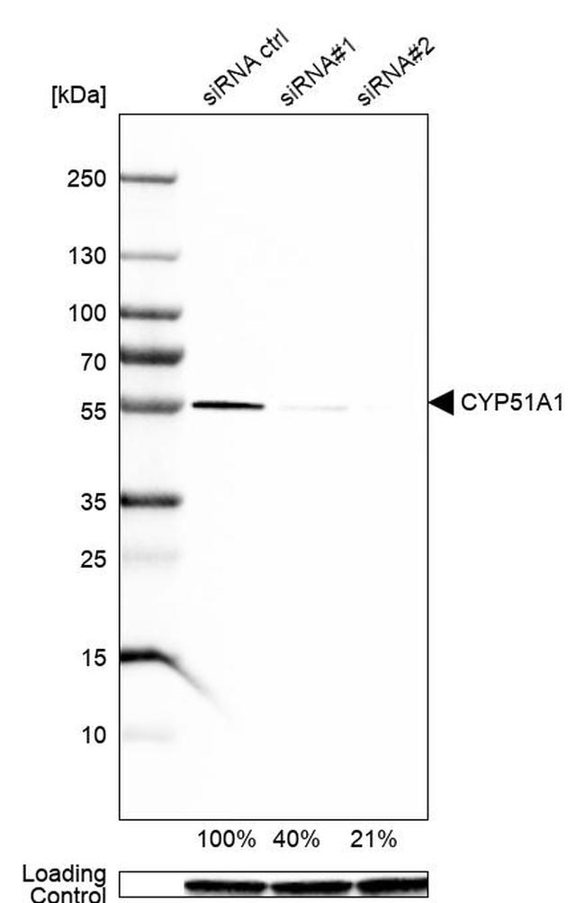 CYP51A1 Antibody in Western Blot (WB)