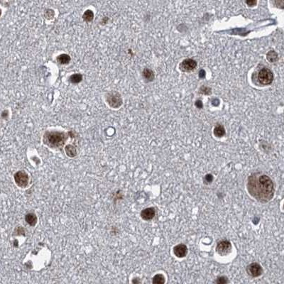 ZC3H18 Antibody in Immunohistochemistry (IHC)