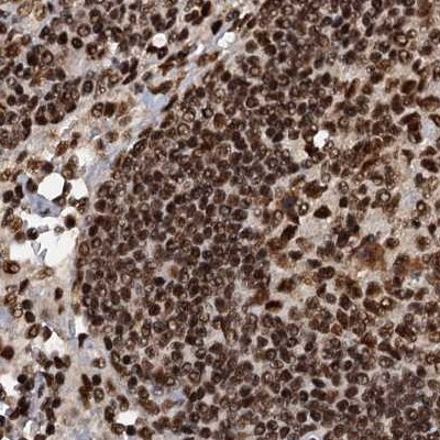 ZC3H18 Antibody in Immunohistochemistry (IHC)