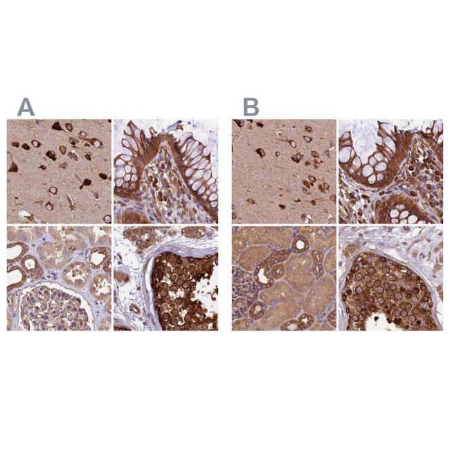 KARS Antibody in Immunohistochemistry (IHC)