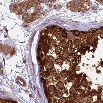 KARS Antibody in Immunohistochemistry (IHC)