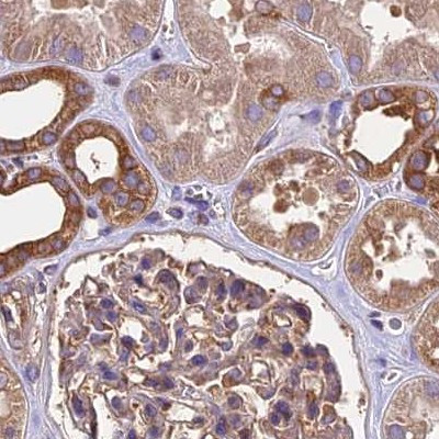 KARS Antibody in Immunohistochemistry (IHC)