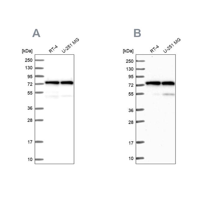 KARS Antibody in Western Blot (WB)