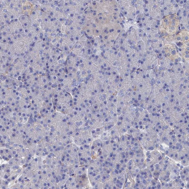 TMOD2 Antibody in Immunohistochemistry (IHC)