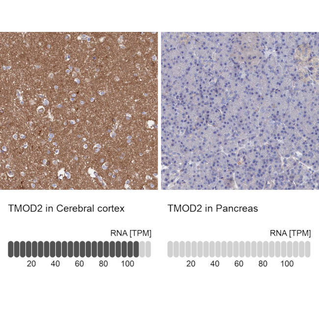 TMOD2 Antibody