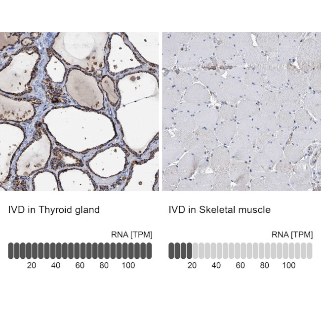 IVD Antibody in Immunohistochemistry (IHC)