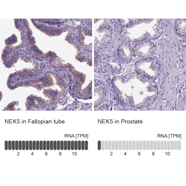 NEK5 Antibody in Immunohistochemistry (IHC)