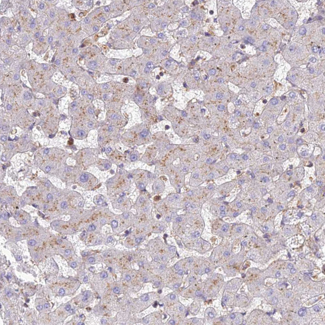 CHMP4B Antibody in Immunohistochemistry (IHC)