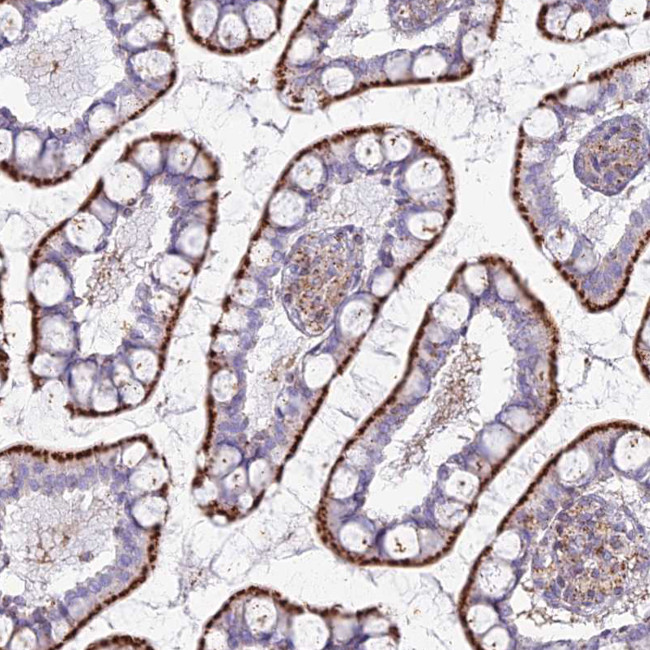 CHMP4B Antibody in Immunohistochemistry (IHC)