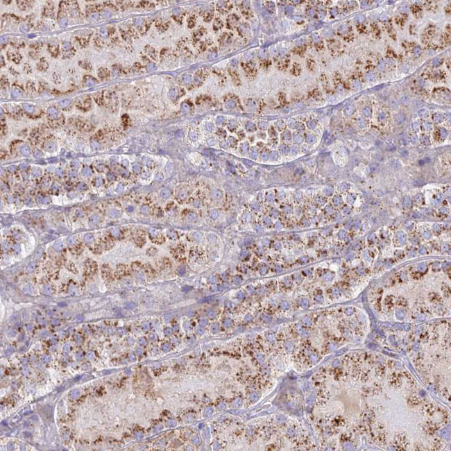 CHMP4B Antibody in Immunohistochemistry (IHC)