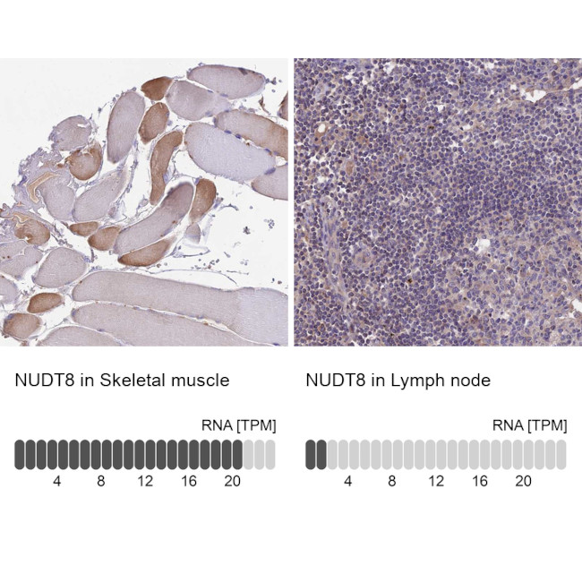 NUDT8 Antibody in Immunohistochemistry (IHC)