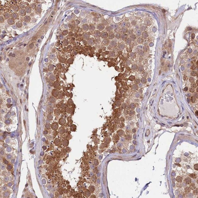 RIC8A Antibody in Immunohistochemistry (IHC)