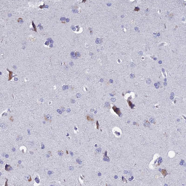 SLC1A6 Antibody in Immunohistochemistry (IHC)