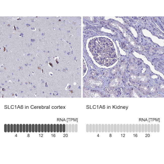 SLC1A6 Antibody