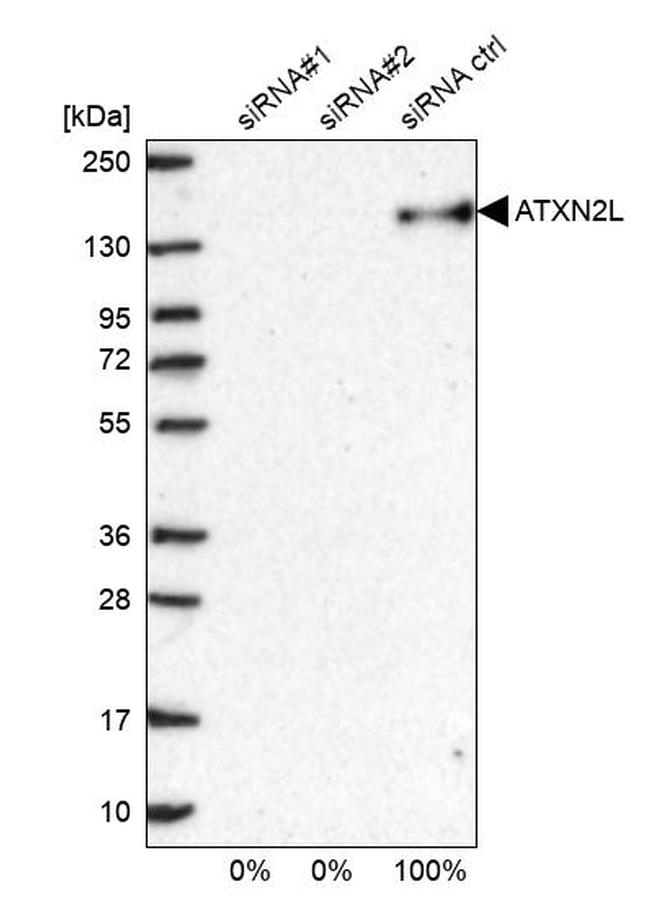 ATXN2L Antibody in Western Blot (WB)