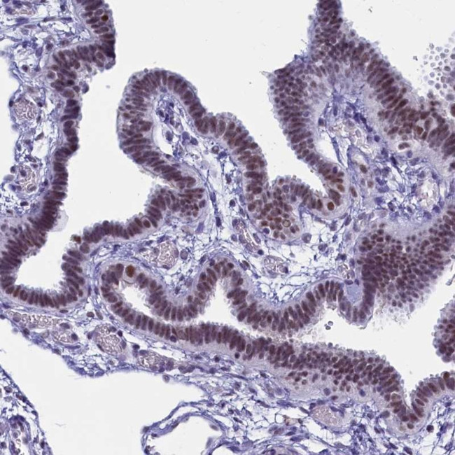 CD2BP2 Antibody in Immunohistochemistry (IHC)