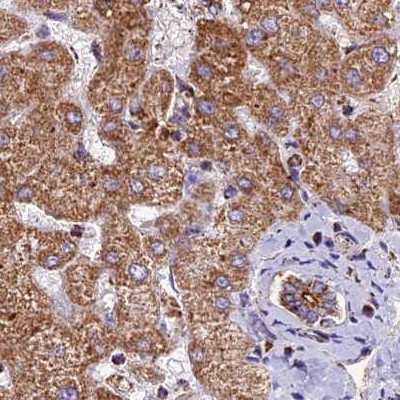 NDUFA8 Antibody in Immunohistochemistry (IHC)