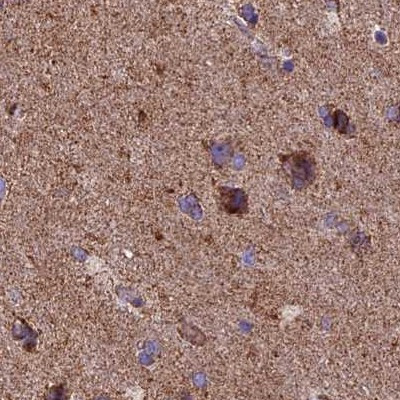 NDUFA8 Antibody in Immunohistochemistry (IHC)