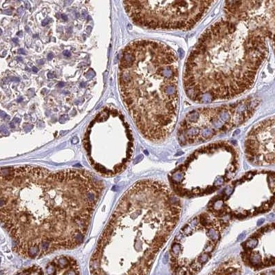 NDUFA8 Antibody in Immunohistochemistry (IHC)