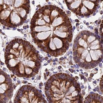 NDUFA8 Antibody in Immunohistochemistry (IHC)