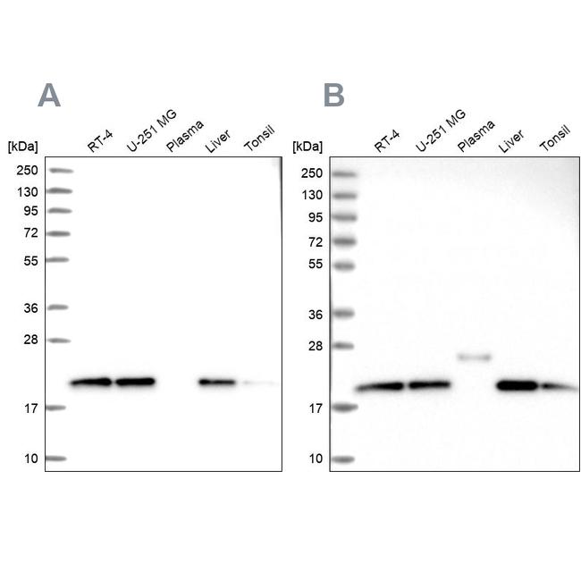 NDUFA8 Antibody in Western Blot (WB)