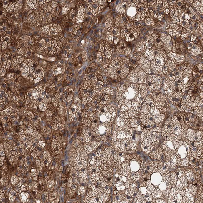 DEXI Antibody in Immunohistochemistry (IHC)