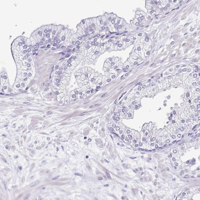 Sarcalumenin Antibody in Immunohistochemistry (IHC)