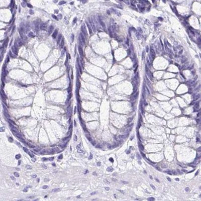 Sarcalumenin Antibody in Immunohistochemistry (IHC)