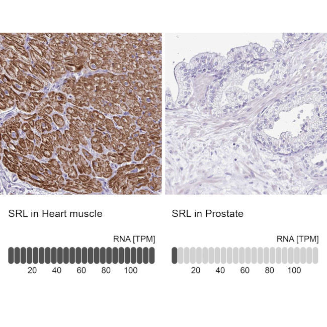 Sarcalumenin Antibody