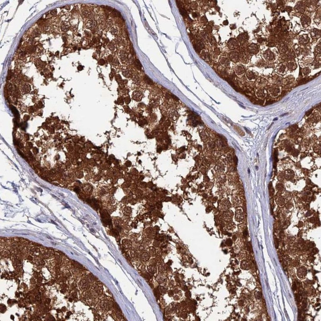 LCMT1 Antibody in Immunohistochemistry (IHC)