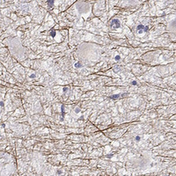 PABPC1L2A Antibody in Immunohistochemistry (IHC)