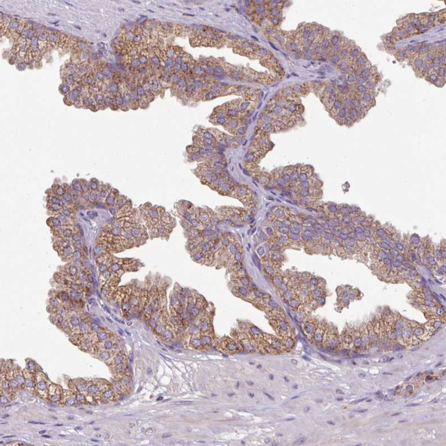 SQRDL Antibody in Immunohistochemistry (IHC)