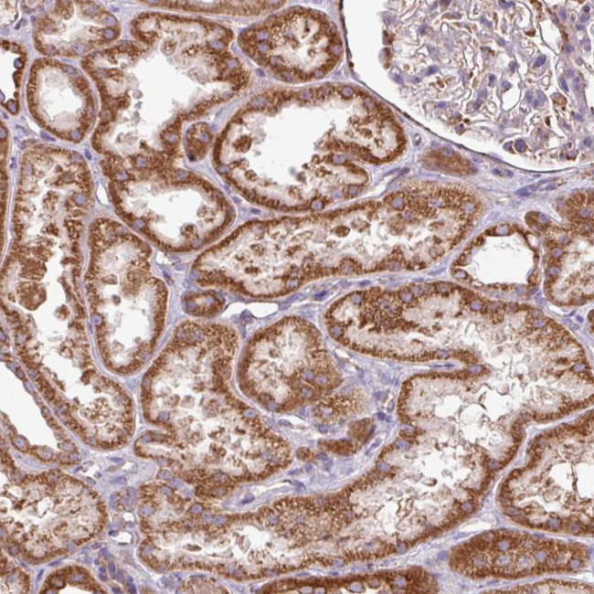 SQRDL Antibody in Immunohistochemistry (IHC)