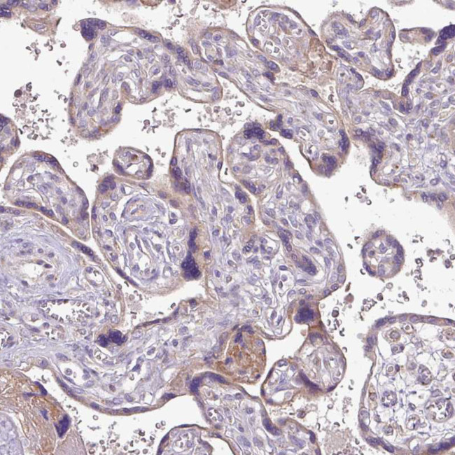 SQRDL Antibody in Immunohistochemistry (IHC)