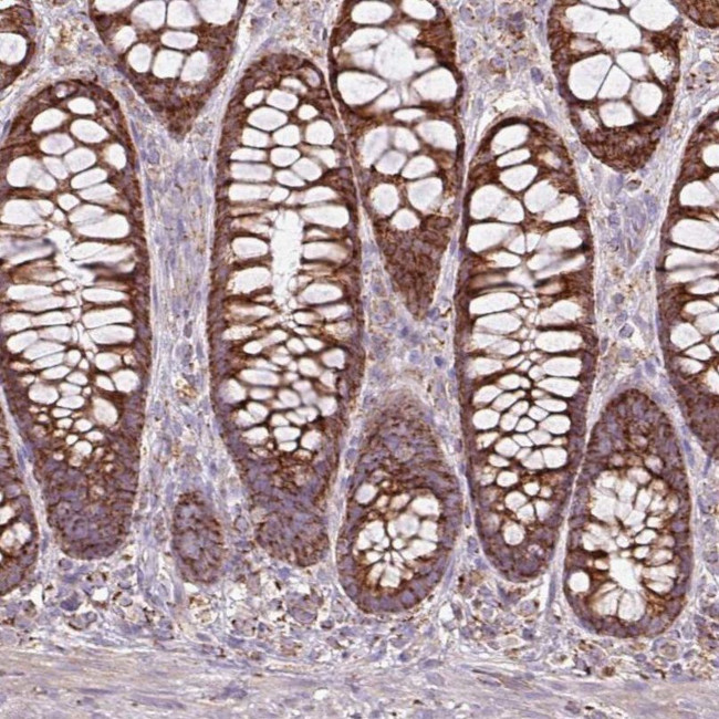 SQRDL Antibody in Immunohistochemistry (IHC)