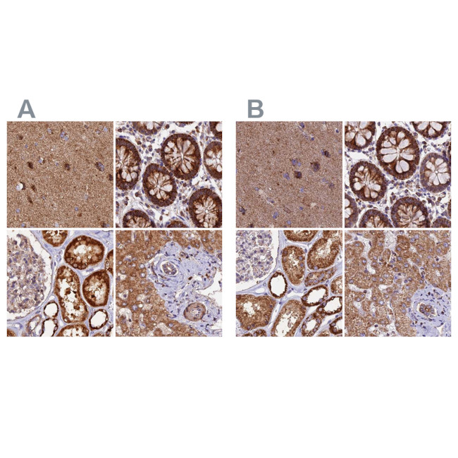 NDUFA8 Antibody in Immunohistochemistry (IHC)