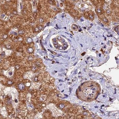 NDUFA8 Antibody in Immunohistochemistry (IHC)