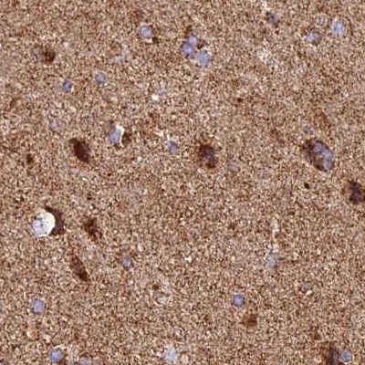 NDUFA8 Antibody in Immunohistochemistry (IHC)