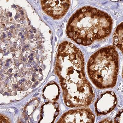 NDUFA8 Antibody in Immunohistochemistry (IHC)