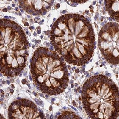 NDUFA8 Antibody in Immunohistochemistry (IHC)