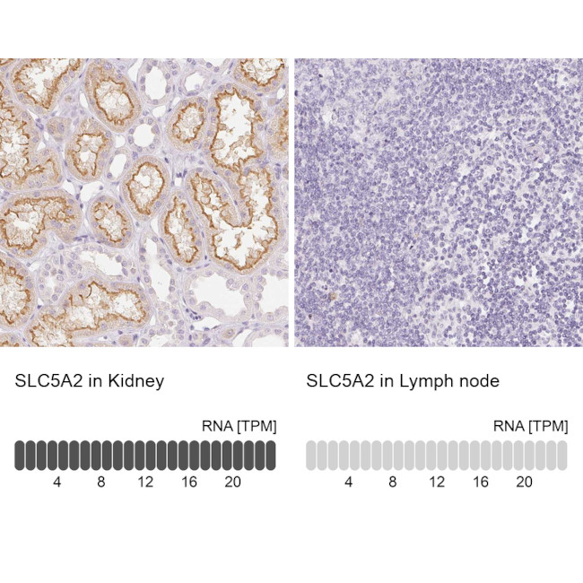 SGLT2 Antibody in Immunohistochemistry (IHC)