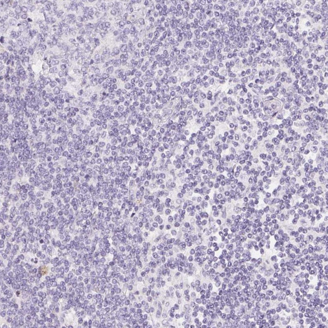 SGLT2 Antibody in Immunohistochemistry (IHC)