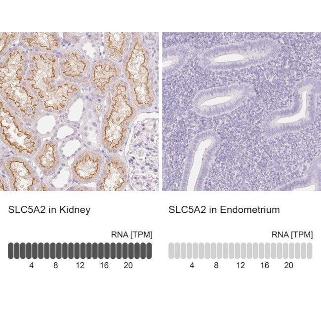 SGLT2 Antibody