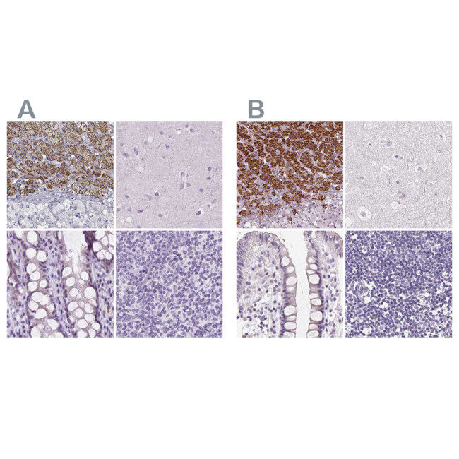 FDX1 Antibody in Immunohistochemistry (IHC)