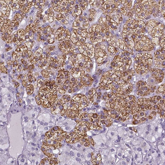 FDX1 Antibody in Immunohistochemistry (IHC)