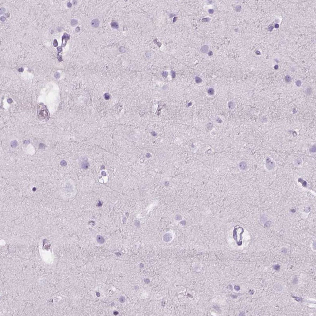 FDX1 Antibody in Immunohistochemistry (IHC)