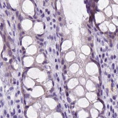 FDX1 Antibody in Immunohistochemistry (IHC)